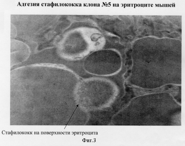 Способ прогнозирования развития анемии при гнойно-воспалительных заболеваниях (патент 2296336)