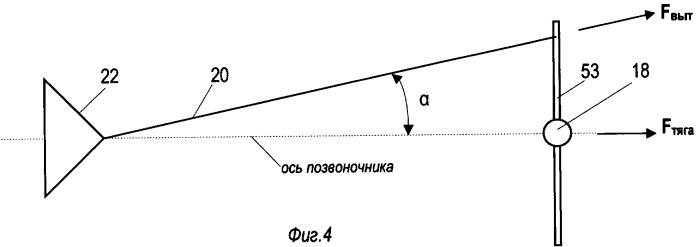 Способ лечения заболеваний позвоночника (патент 2308257)