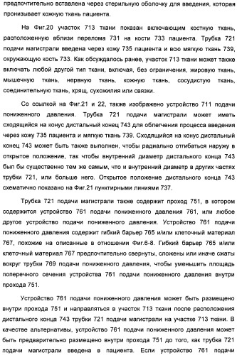 Устройство для лечения путем подкожной подачи пониженного давления с использованием текучей магистрали и связанный с ним способ (патент 2405459)