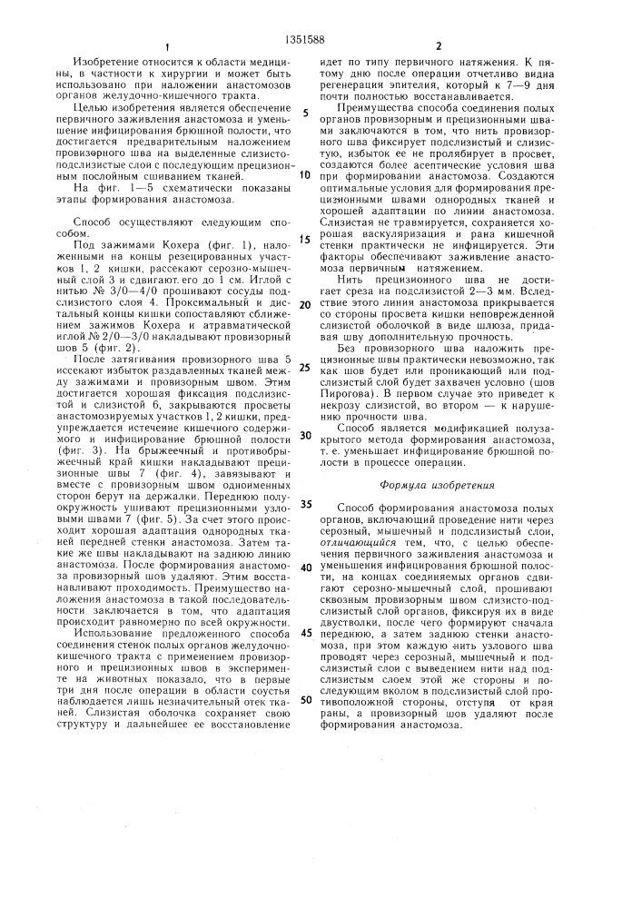 Способ формирования анастомоза полых органов (патент 1351588)