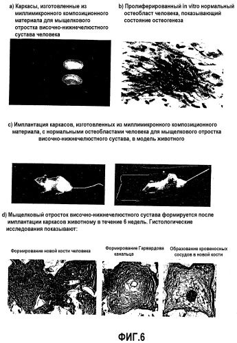 Каркасы для инженерии костной ткани человека, способы их изготовления и их применение (патент 2308974)