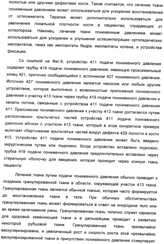 Система и способ продувки устройства пониженного давления во время лечения путем подачи пониженного давления (патент 2404822)