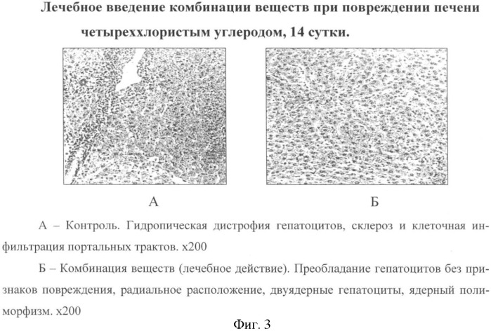 Способ уменьшения токсического повреждения печени (патент 2342132)