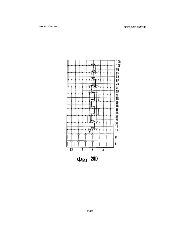 Протез и способ его производства (патент 2606745)