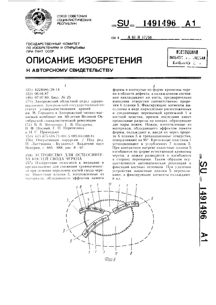 Устройство для остеосинтеза костей свода черепа (патент 1491496)