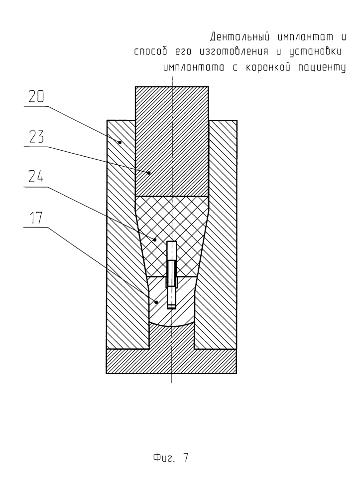 Дентальный имплантат и способ его изготовления (патент 2624169)