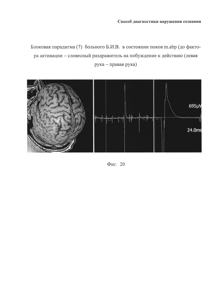 Способ диагностики нарушения сознания (патент 2596049)