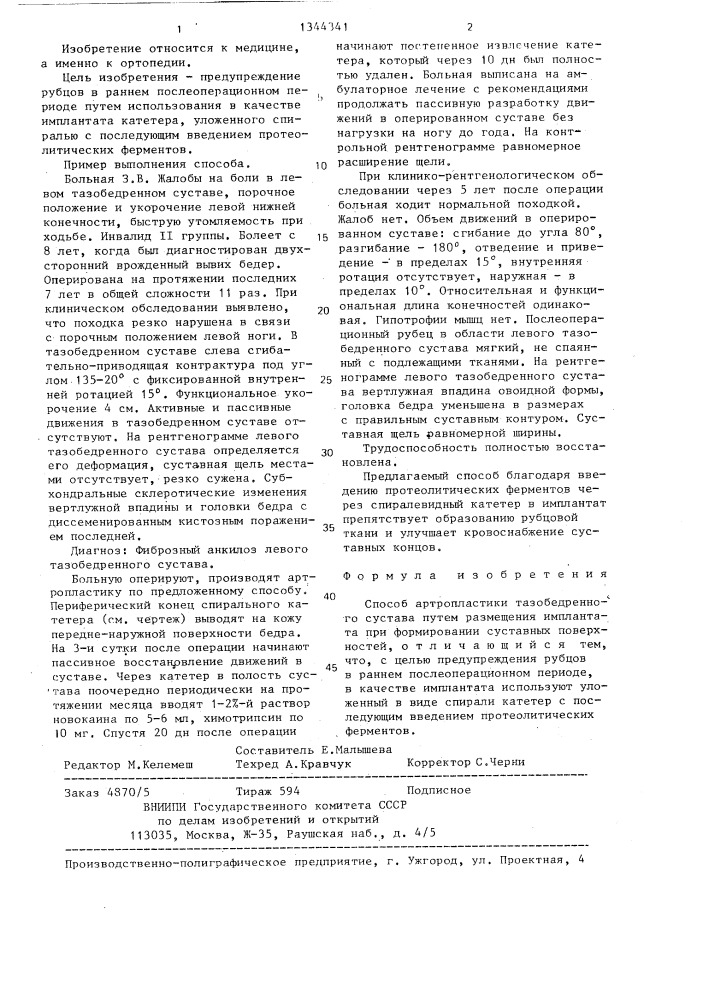 Способ артропластики тазобедренного сустава (патент 1344341)