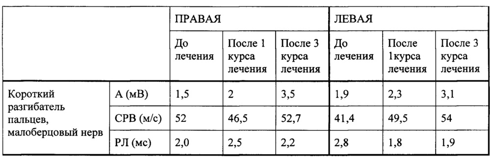 Способ восстановления функции нервов (патент 2662657)