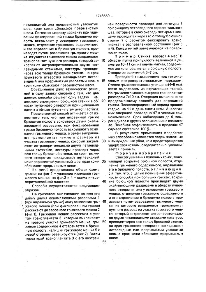 Способ ушивания пупочных грыж (патент 1748669)