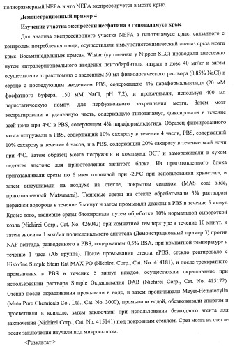 Способ получения фактора, связанного с контролем над потреблением пищи и/или массой тела, полипептид, обладающий активностью подавления потребления пищи и/или прибавления в весе, молекула нуклеиновой кислоты, кодирующая полипептид, способы и применение полипептида (патент 2418002)