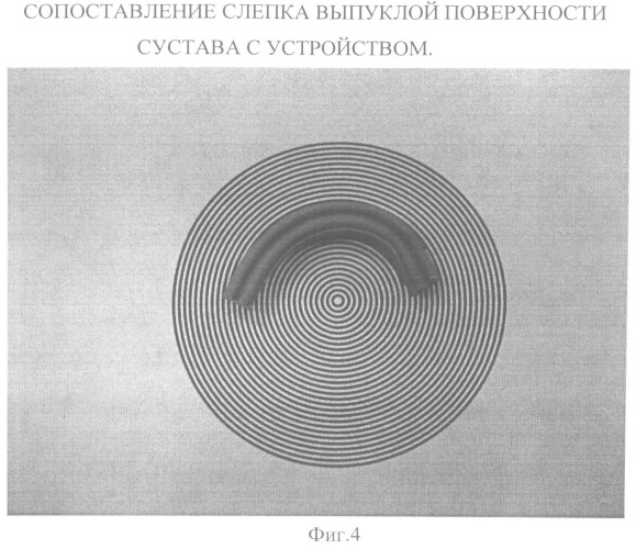 Устройство и способ для определения радиуса кривизны суставных поверхностей (патент 2492837)