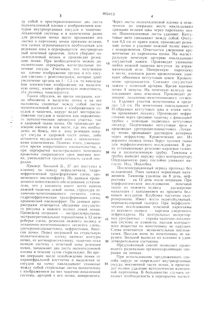 Патент ссср  895413 (патент 895413)