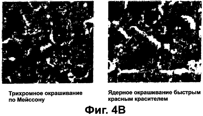 Фармацевтическая композиция для регенерации цирротической печени (патент 2291696)