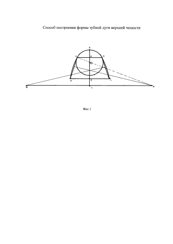 Способ построения формы зубной дуги верхней челюсти (патент 2591629)