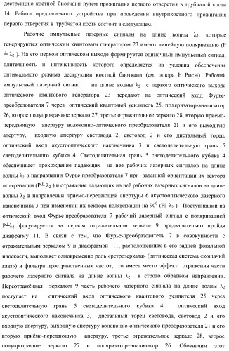 Способ дистального блокирования интрамедуллярных стержней при остеосинтезе длинных трубчатых костей и устройство для его осуществления (патент 2387401)