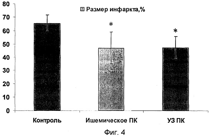 Способ прекондиционирования миокарда (патент 2312691)