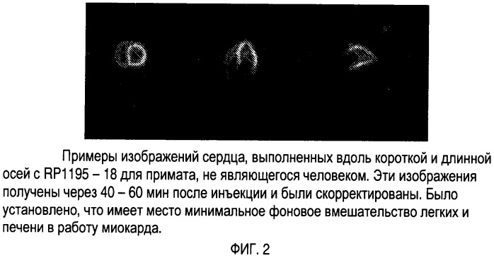 Лиганды для визуализации иннервации сердца (патент 2506256)