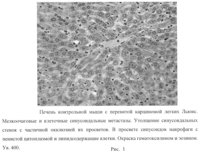 N-[3-оксо-лупано-28-ил]-морфолин - средство коррекции цитотоксических повреждений печени с противоопухолевой и антиметастатической активностью (патент 2461563)