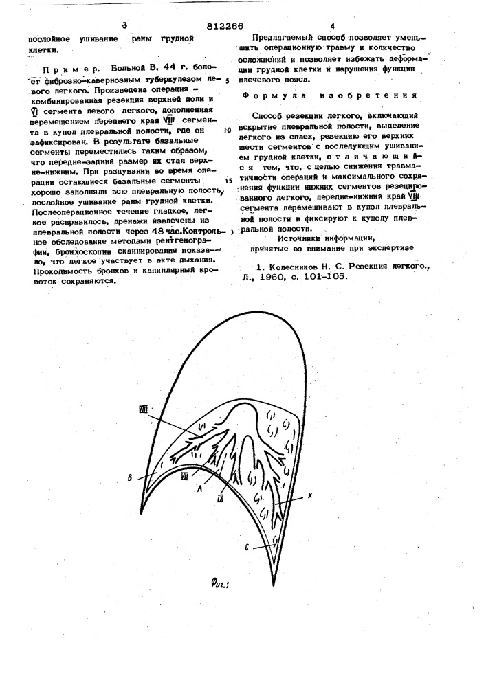 Способ резекции легкого (патент 812266)