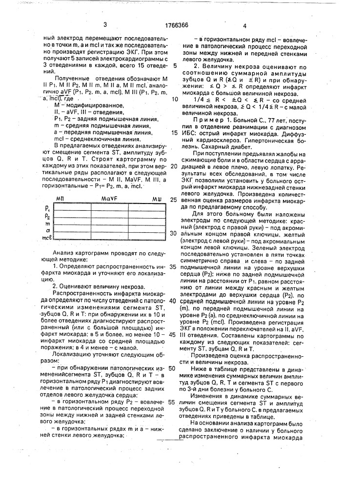 Способ электрокардиографической оценки размеров инфаркта миокарда нижнезадней стенки левого желудочка (патент 1766366)