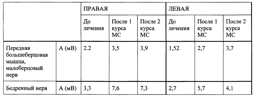 Способ восстановления функции нервов (патент 2662657)