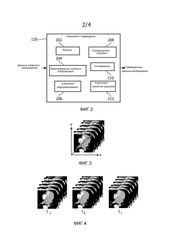 Совмещение данных изображения для динамической перфузионной компьютерной томографии (патент 2582055)