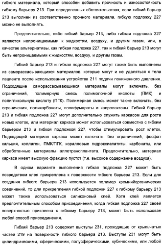 Устройство для лечения путем подкожной подачи пониженного давления с использованием текучей магистрали и связанный с ним способ (патент 2405459)