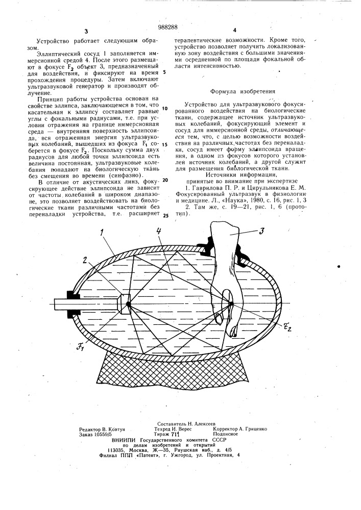 Устройство для ультразвукового фокусированного воздействия на биологические ткани (патент 988288)