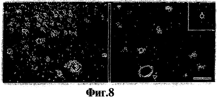 Производные тиофлавина, связывающие амилоид, способ обнаружения in vivo отложений амилоида и способ распознавания болезни альцгеймера (патент 2324686)