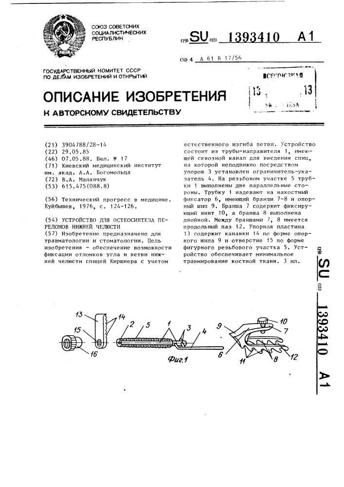 Устройство для остеосинтеза переломов нижней челюсти (патент 1393410)