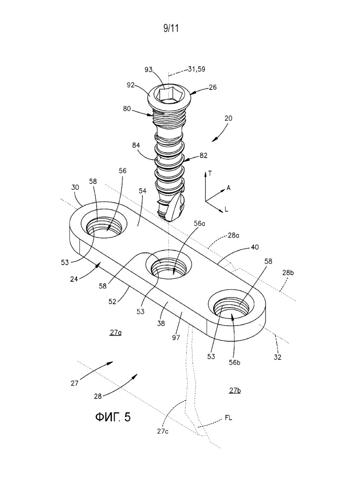 Система фиксации кости (патент 2648850)
