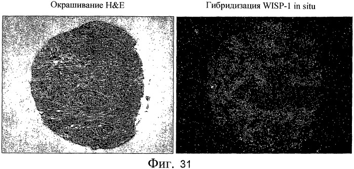 Способы и композиции для модуляции и обнаружения активности wisp (патент 2412201)