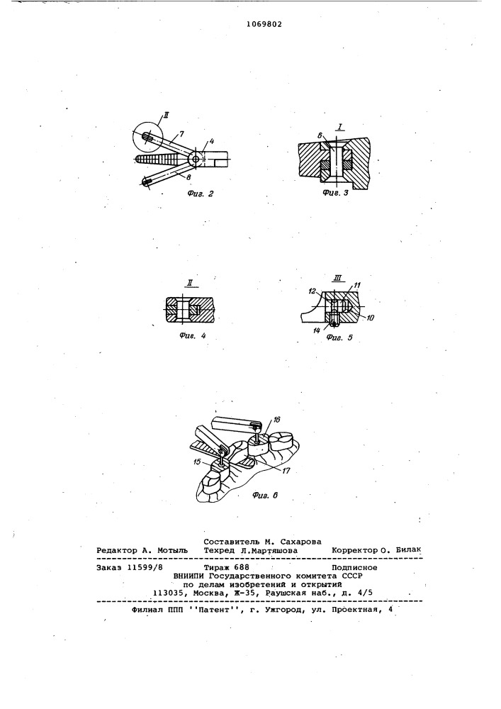 Устройство для снятия литых мостовидных протезов (патент 1069802)