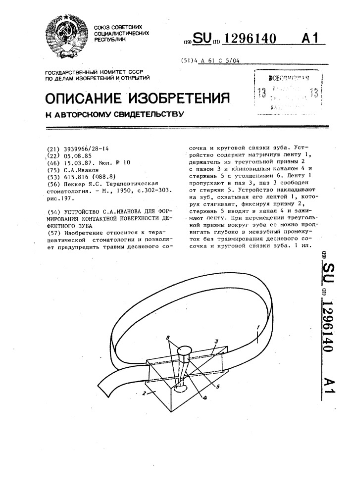 Устройство с.а.иванова для формирования контактной поверхности дефектного зуба (патент 1296140)