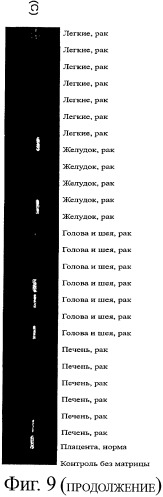 Идентификация опухолевых антигенов для диагностики и терапии (патент 2485974)