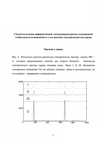 Способ получения информативной электрокардиограммы повышенной стабильности независимой от угла наклона электрической оси сердца (патент 2580976)