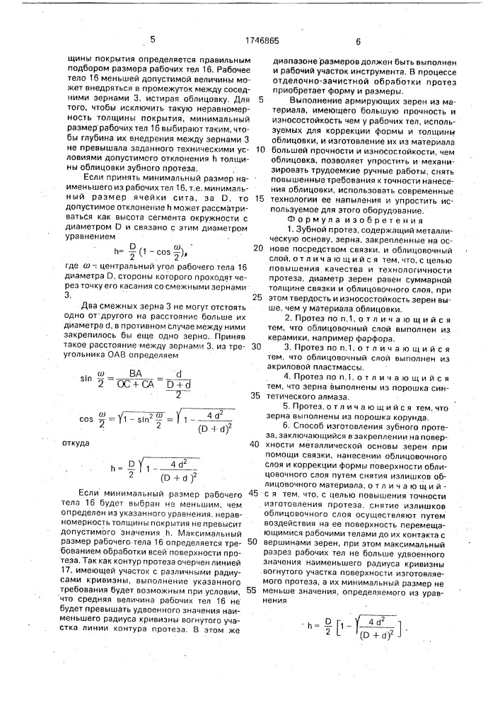 Зубной протез и способ его изготовления (патент 1746865)