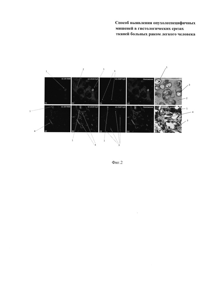 Способ выявления опухолеспецифичных мишеней в гистологических срезах тканей больных раком легкого человека (патент 2639238)