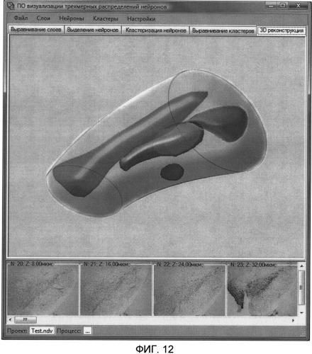 Автоматизированная система реконструкции 3d распределения нейронов по серии изображений срезов головного мозга (патент 2504012)