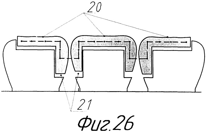 Способ шинирования зубов (варианты) (патент 2340306)
