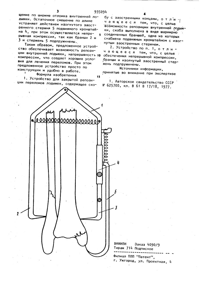 Устройство для закрытой репозиции переломов лодыжек (патент 935094)