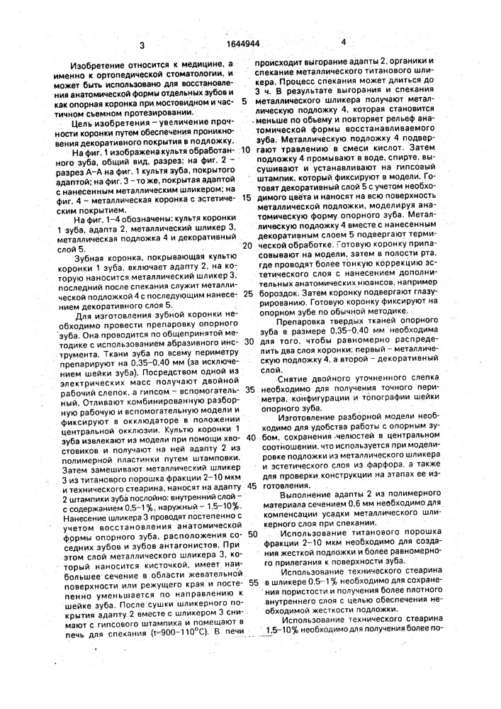 Зубная коронка (патент 1644944)
