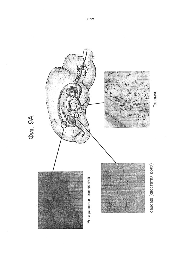 Способы и композиции для лечения болезней мозга (патент 2664471)