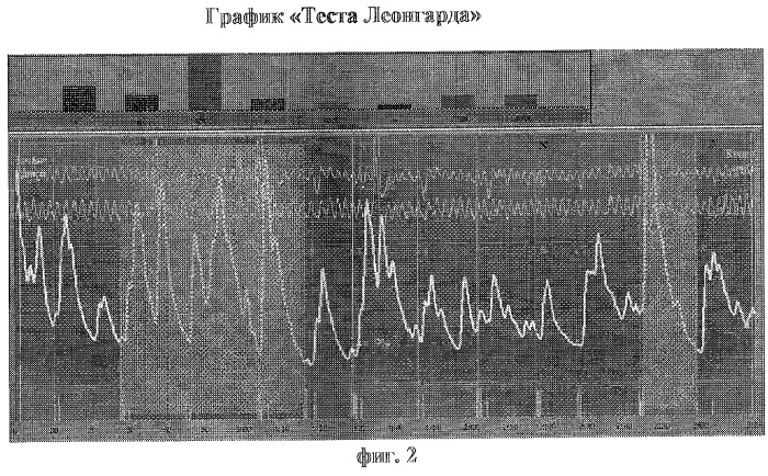 Способ диагностики нарушений сексуальных предпочтений (патент 2283029)