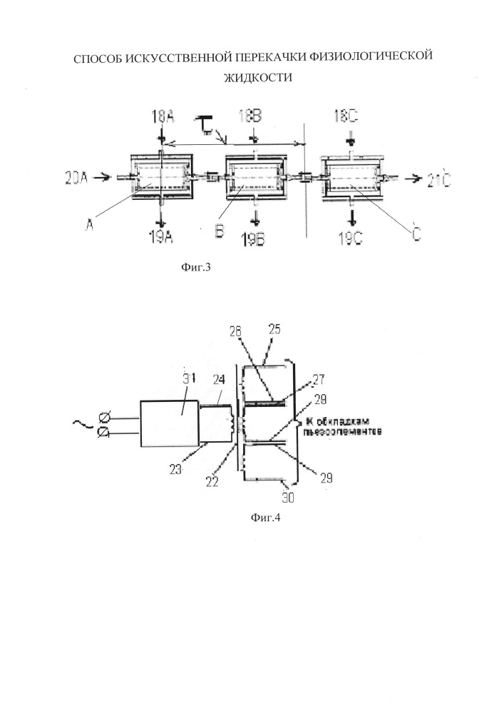 Способ искусственной перекачки физиологической жидкости (патент 2654618)