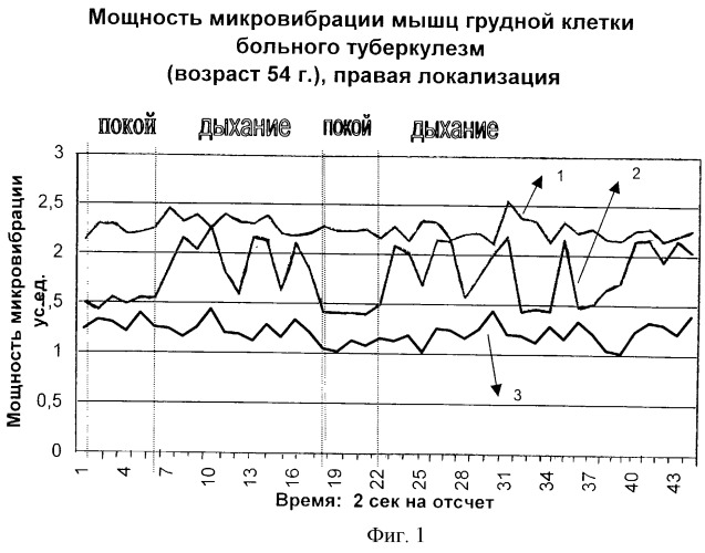 Способ выявления локализации патологического процесса у человека и животного и устройство для его реализации (патент 2260374)