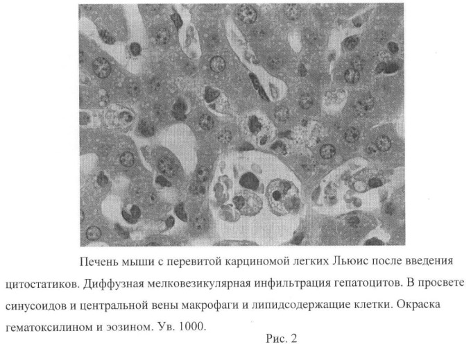 N-[3-оксо-лупано-28-ил]-морфолин - средство коррекции цитотоксических повреждений печени с противоопухолевой и антиметастатической активностью (патент 2461563)