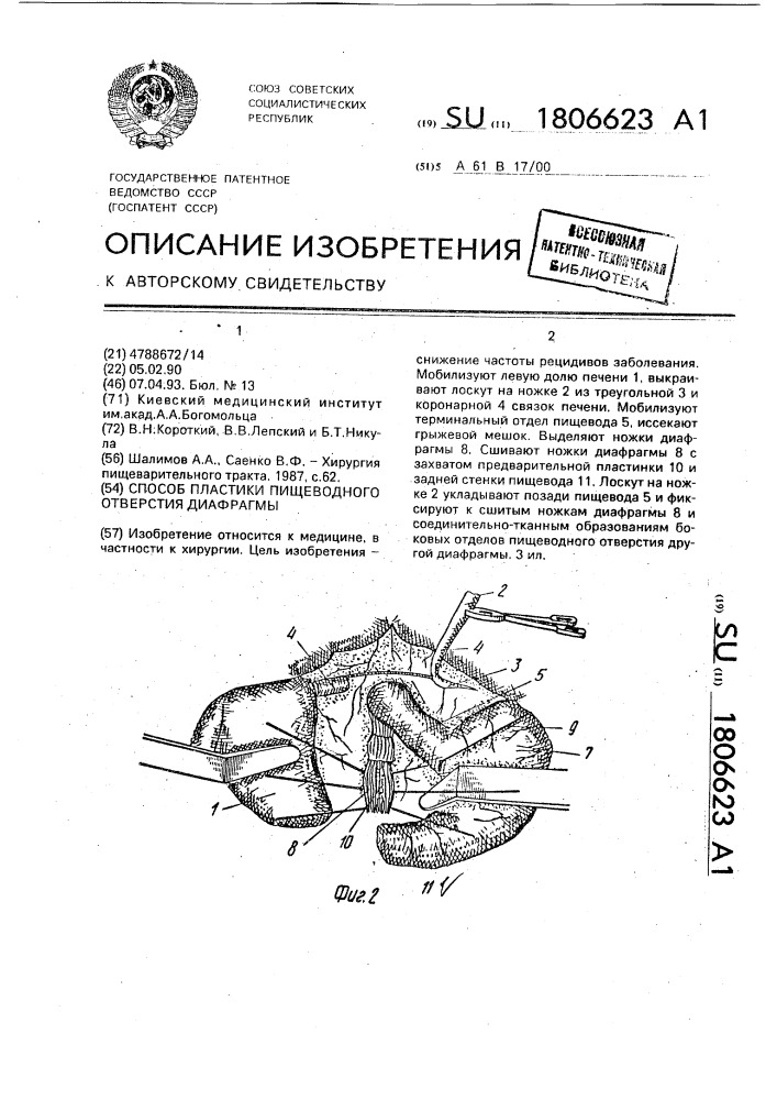 Способ пластики пищеводного отверстия диафрагмы (патент 1806623)