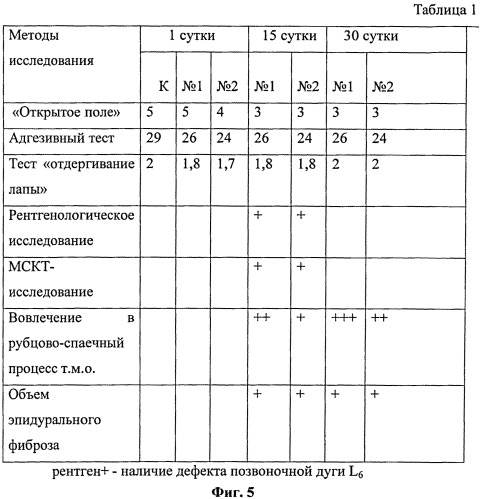 Способ моделирования профилактики послеоперационного рубцово-спаечного эпидурита (патент 2541828)